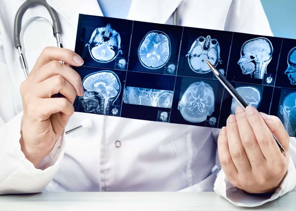 traumatic brain injury evidence