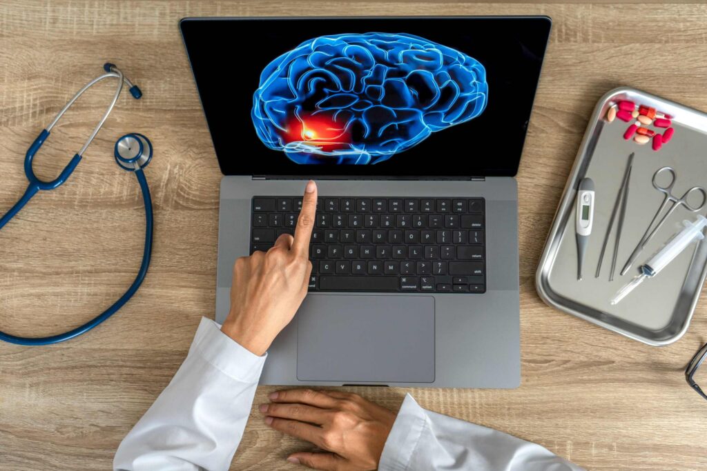 Doctor pointing at a 3D brain scan model on a laptop screen for documenting a Texas brain injury claim.